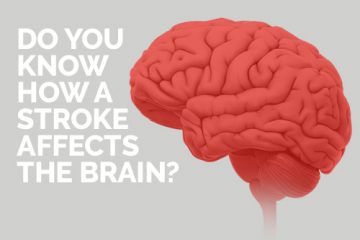 A rendering of the human brain with text asking if you know how stroke affects it