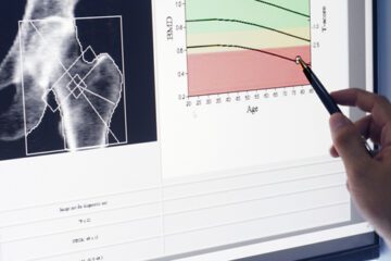 an image showing bone density test